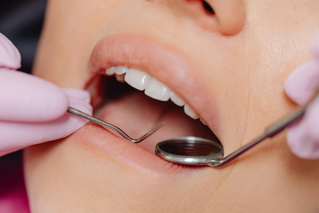 Image showing macrodontia teeth treatment